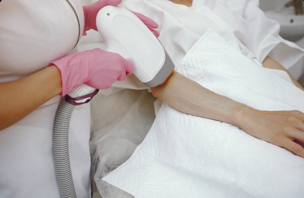 Electrolysis The Ultimate Guide to Permanent Hair Removal