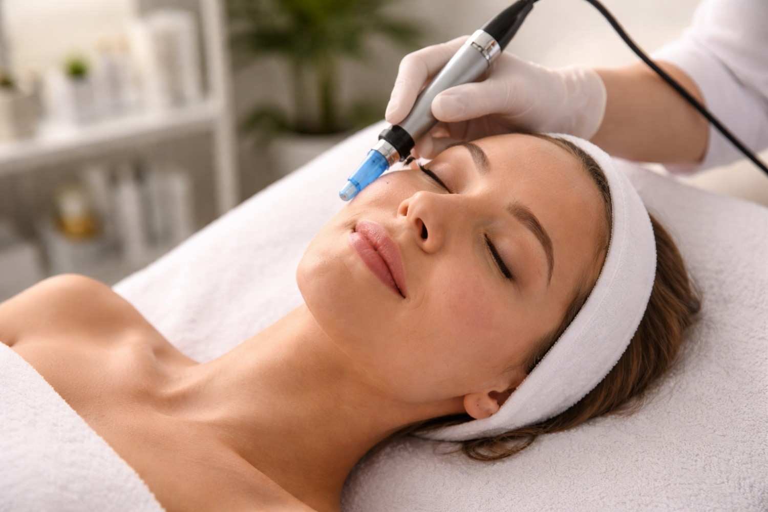 Realistic Results You Can Expect from Microneedling in Houston